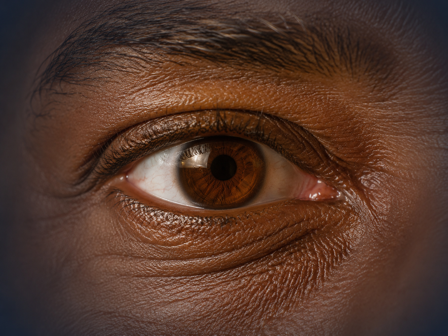 Imagem ilustrativa sobre Glaucoma